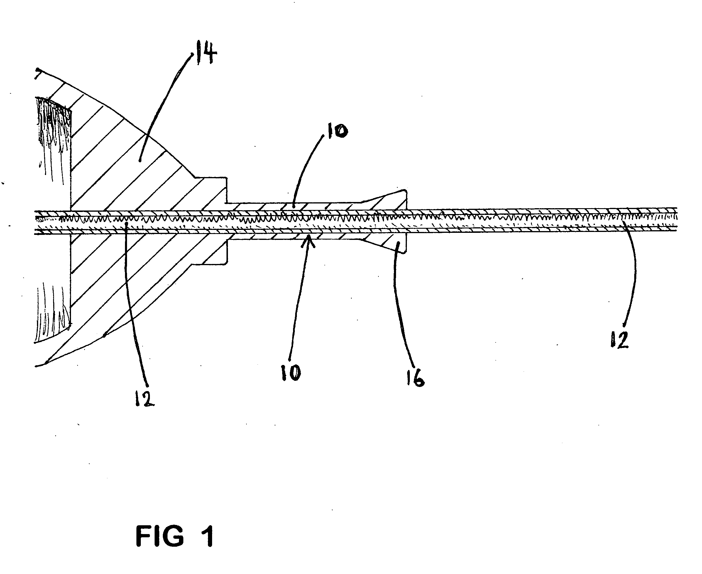 Needle hub assembly