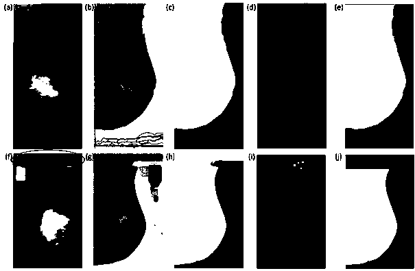 Breast molybdenum target image breast area segmentation and calcification point detection method