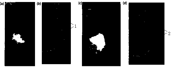 Breast molybdenum target image breast area segmentation and calcification point detection method