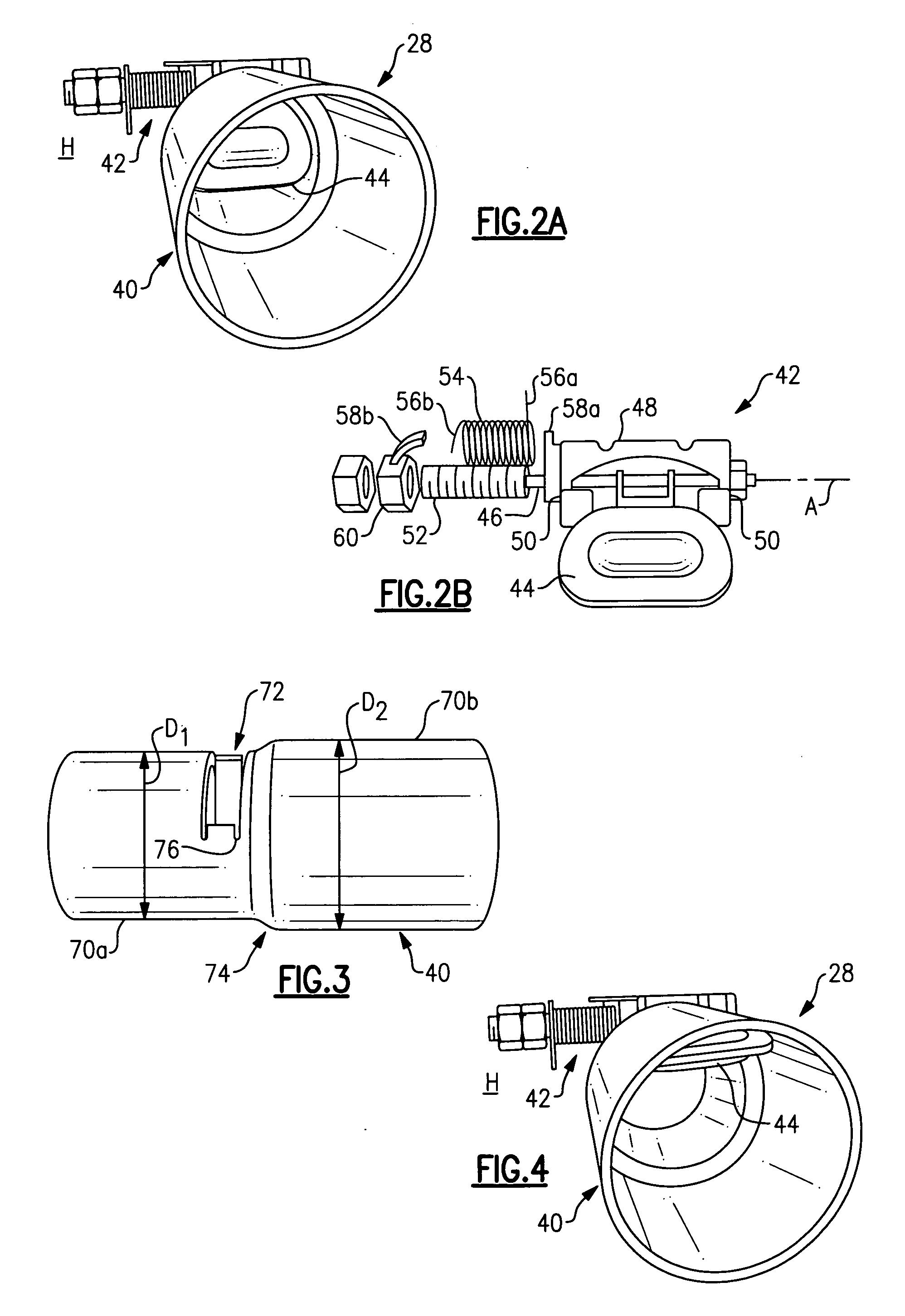 Passive throttling valve outside of muffler