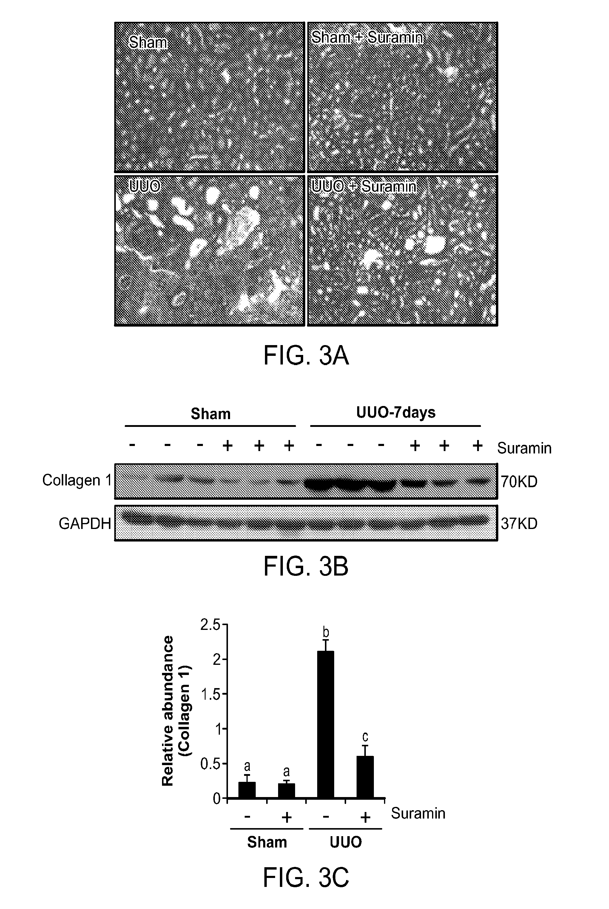 Inhibition of Renal Fibrosis