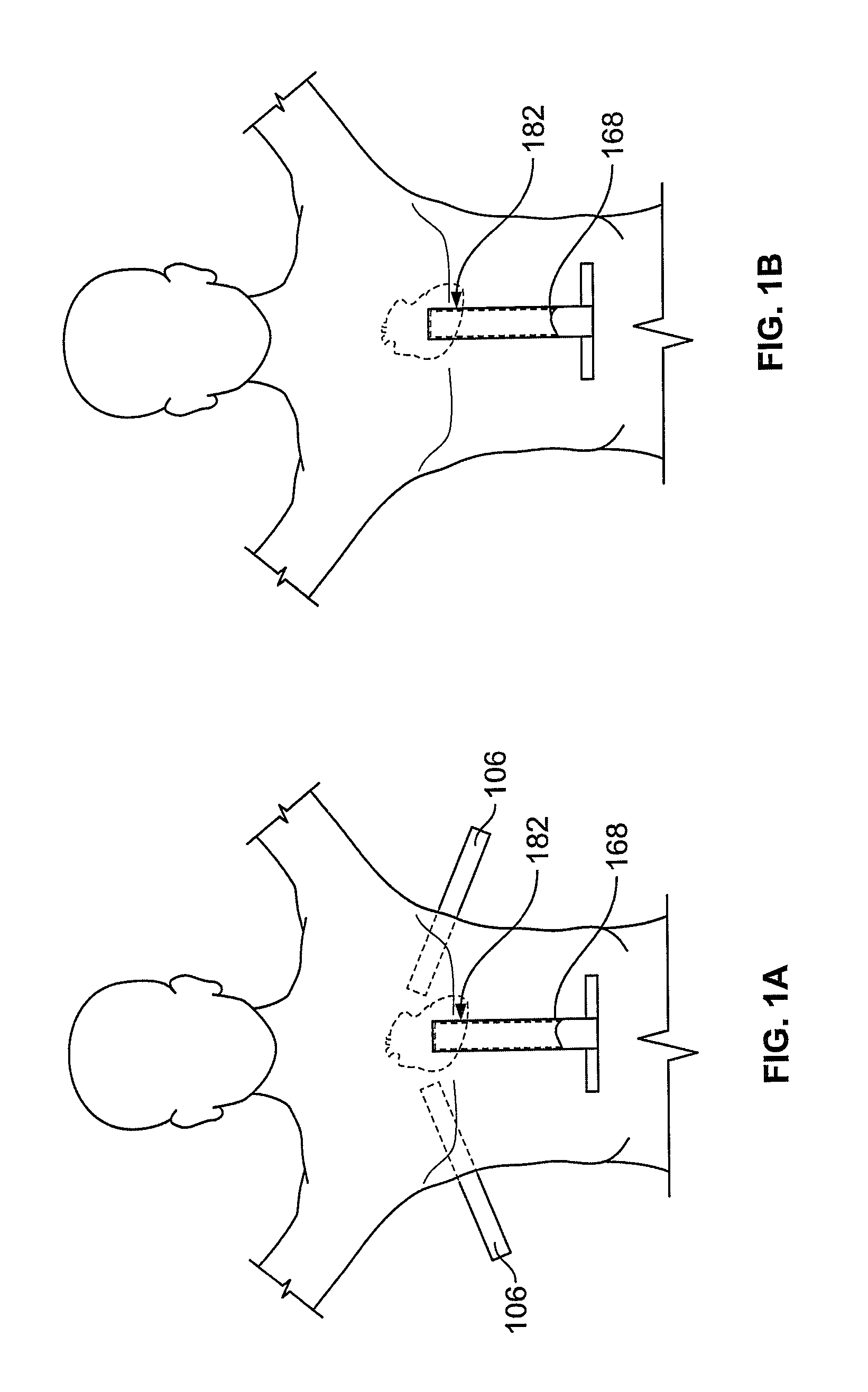 Diaphragm entry for posterior surgical access