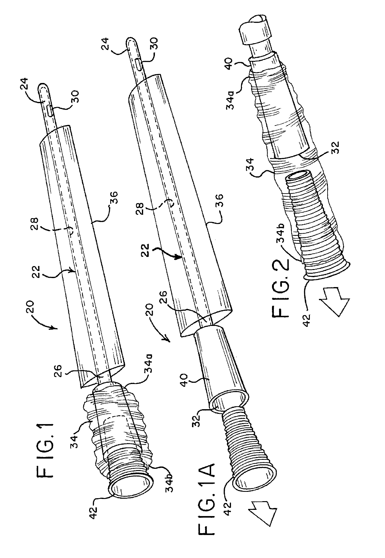 Intermittent urinary catheter assembly and an adapter assembly for an intermittent urinary catheter