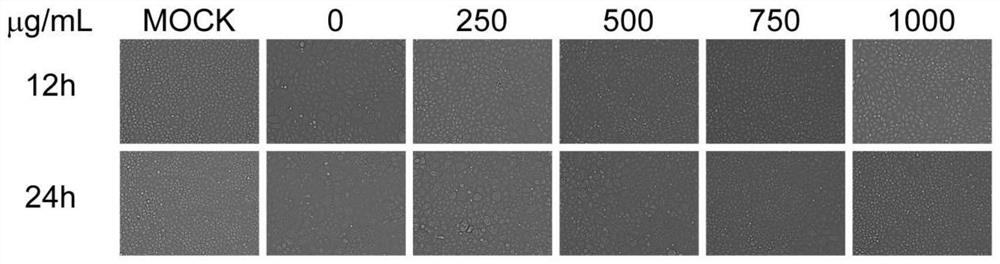 Application of hippophae rhamnoides polysaccharide in preparing of preparation for preventing and/or treating porcine pseudorabies virus infection