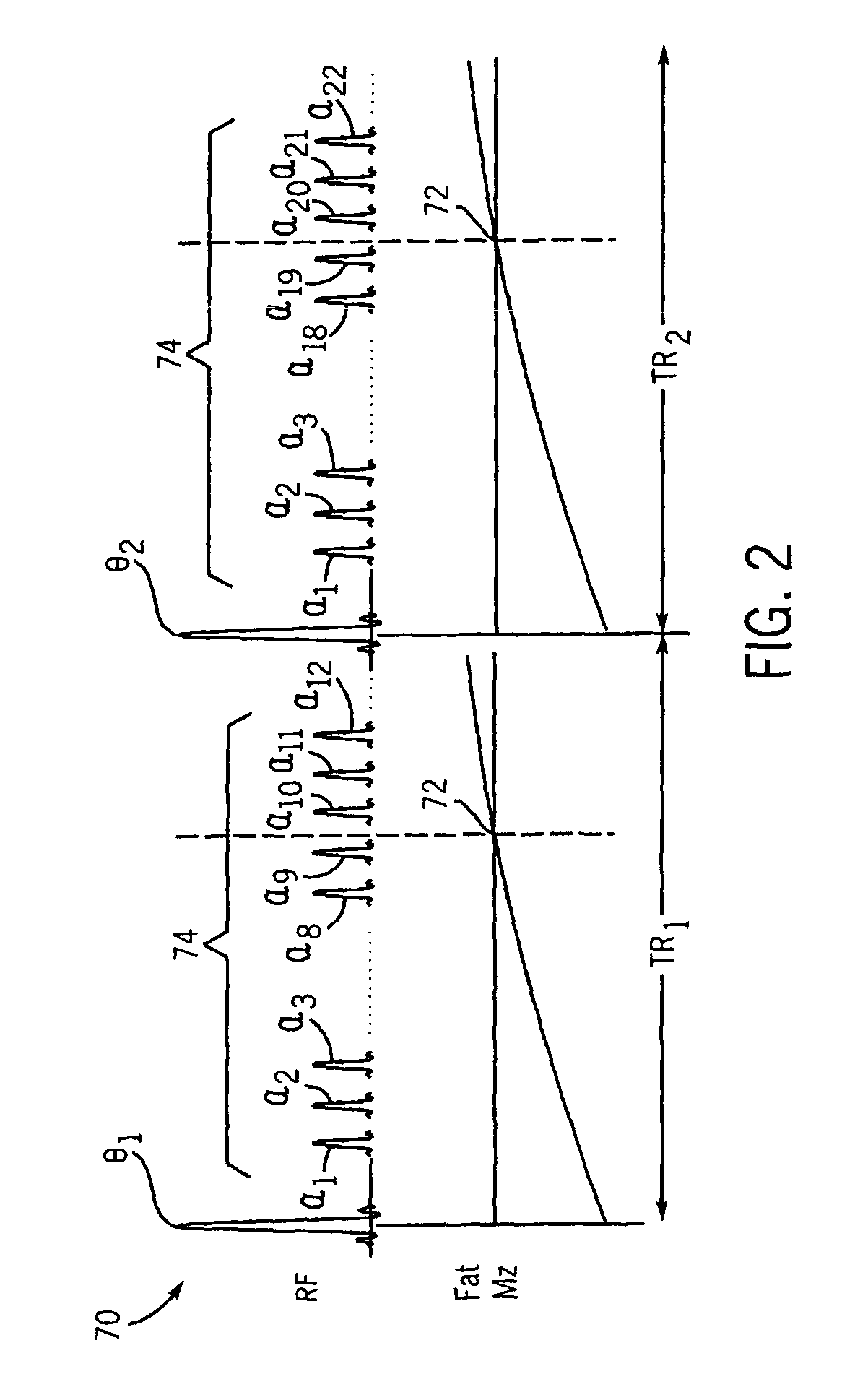 Method and apparatus of gradient echo imaging with on-the-fly optimization of tissue suppression