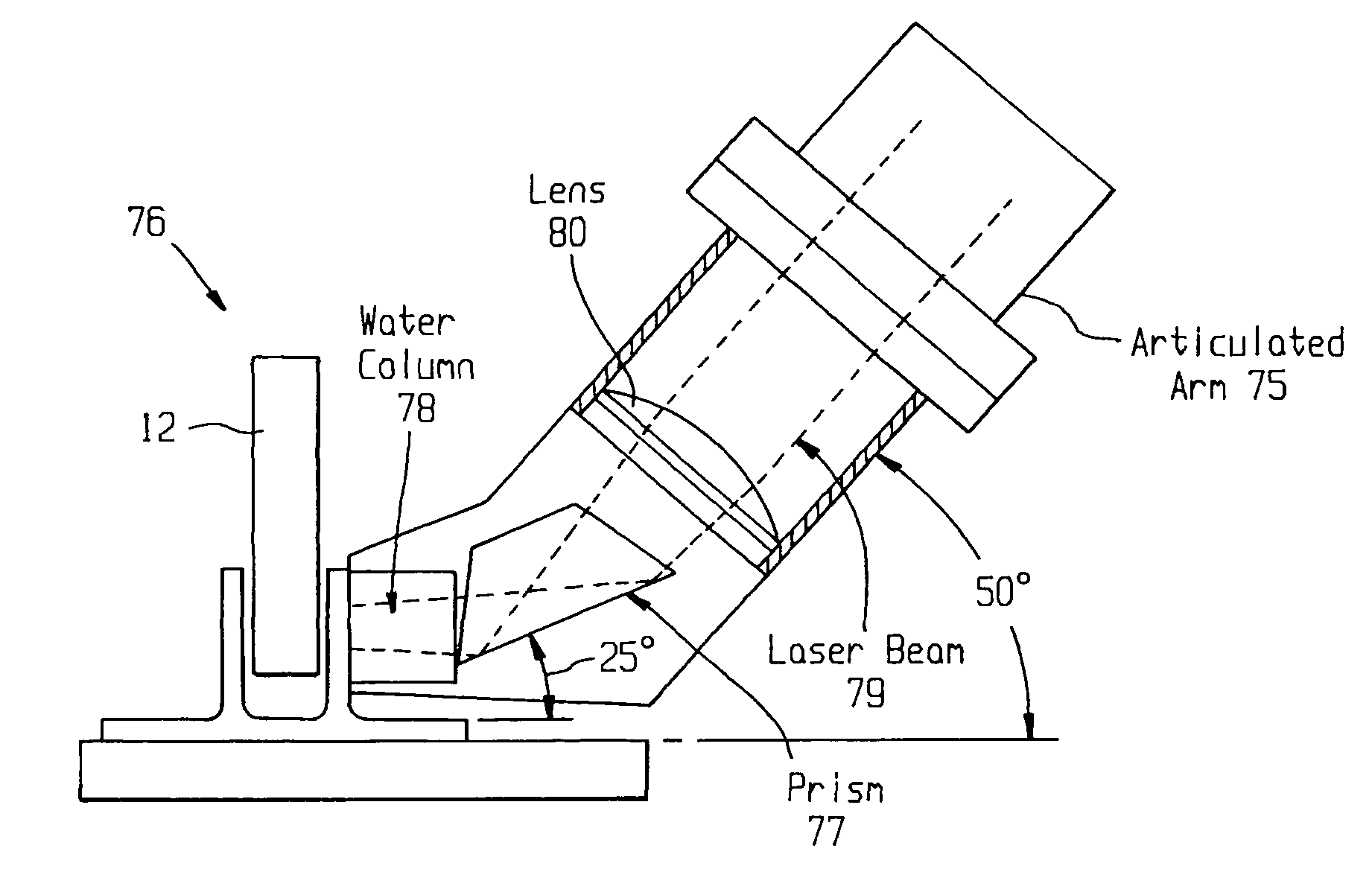 Laser system and method for non-destructive bond detection and evaluation