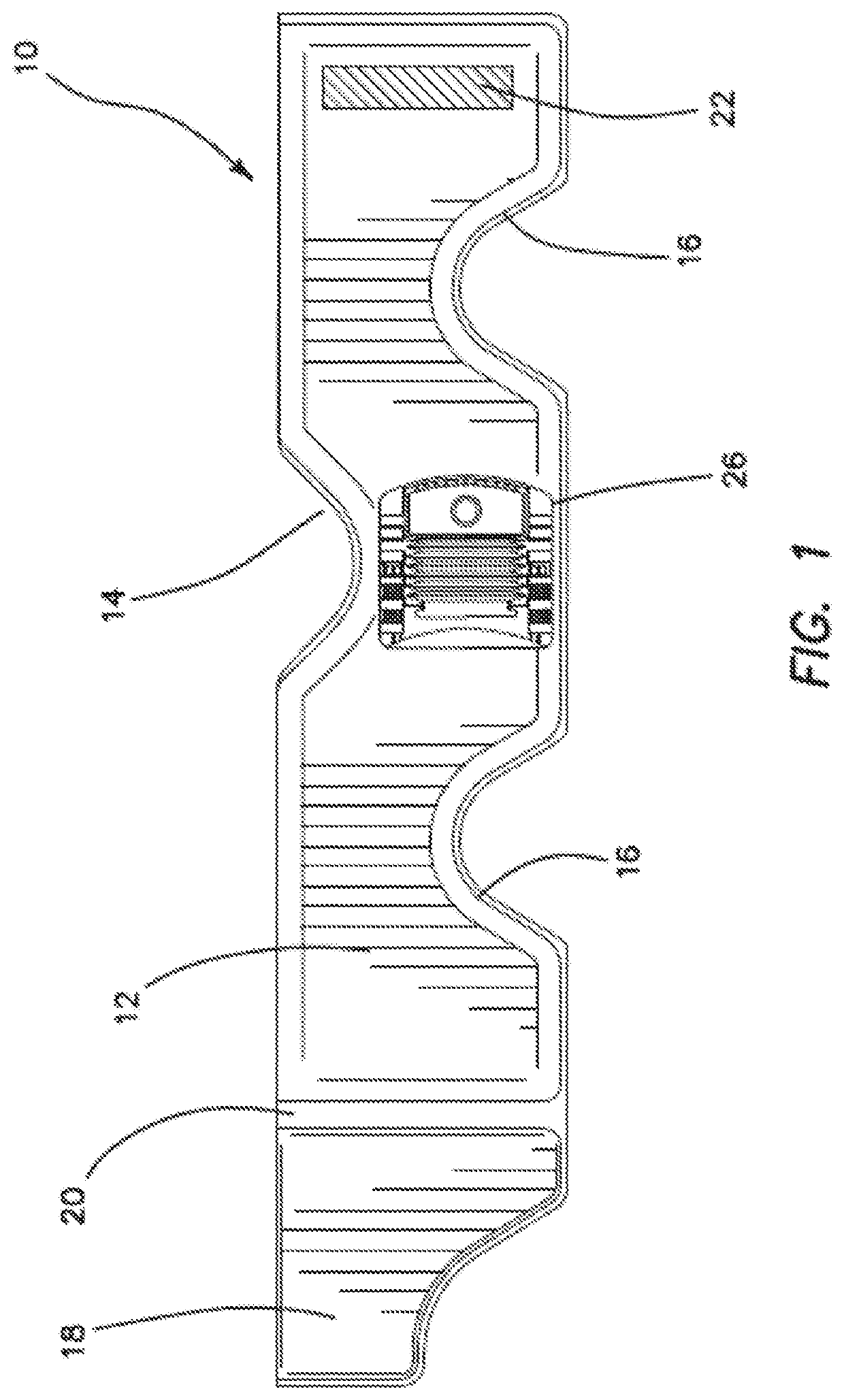 Vacuum splint apparatus for accommodating the chin of a patient and method for using the same