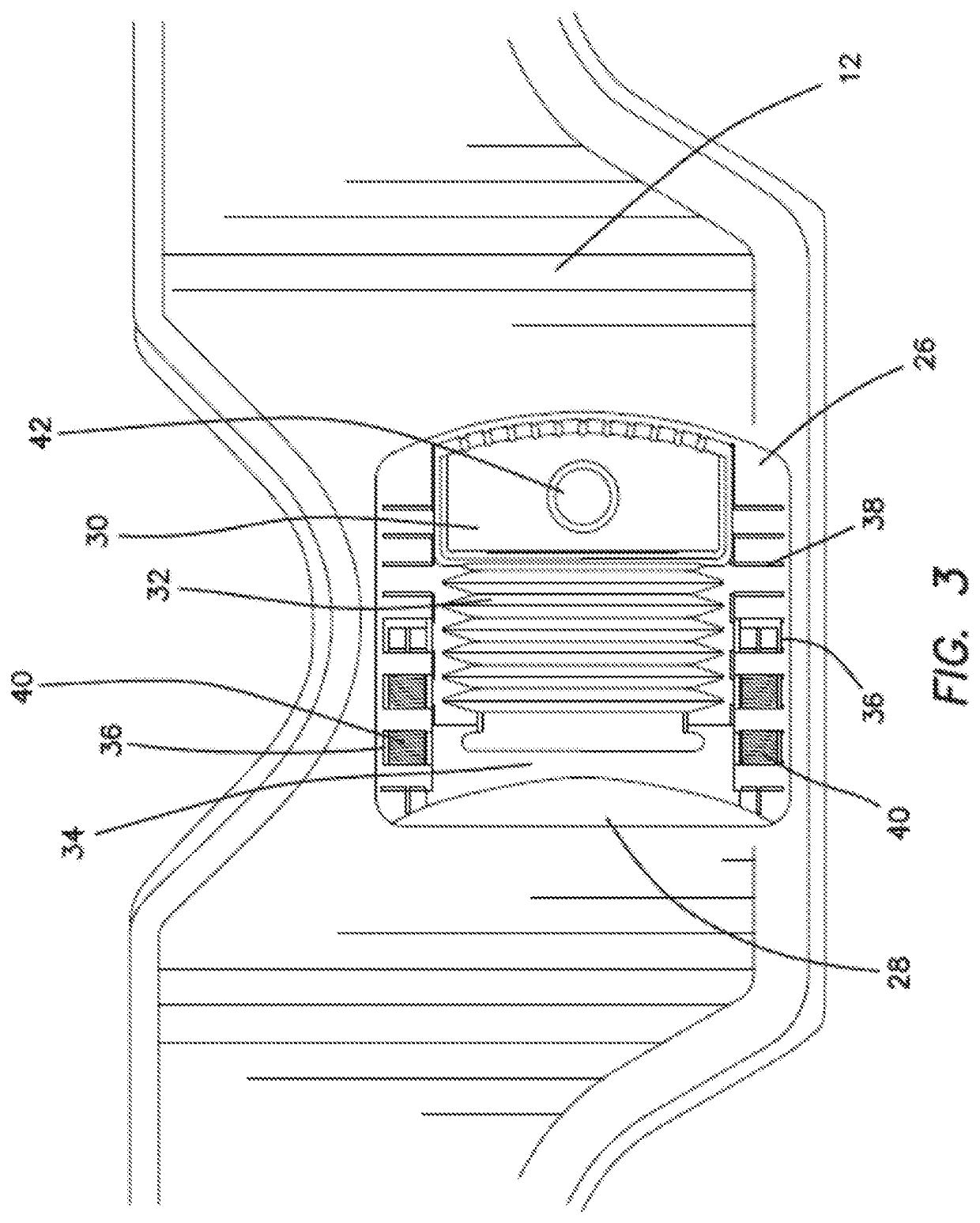 Vacuum splint apparatus for accommodating the chin of a patient and method for using the same