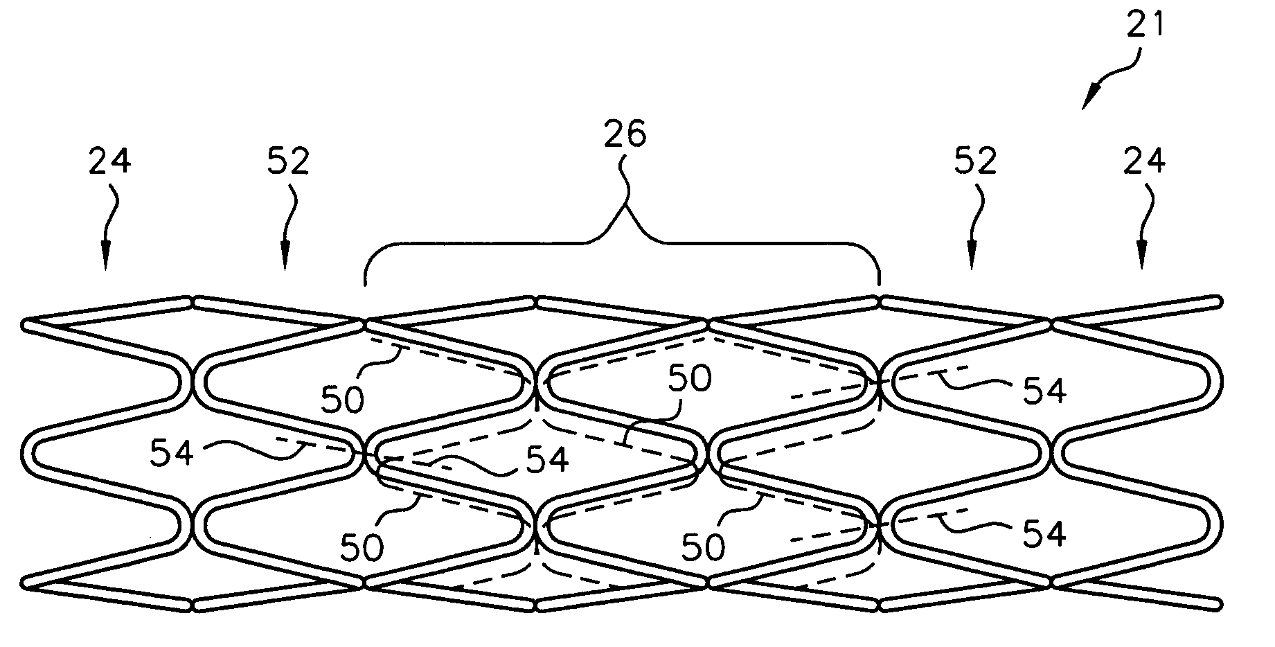 Endoluminal stent having a matched stiffness region and/or a stiffness gradient and methods for providing stent kink resistance