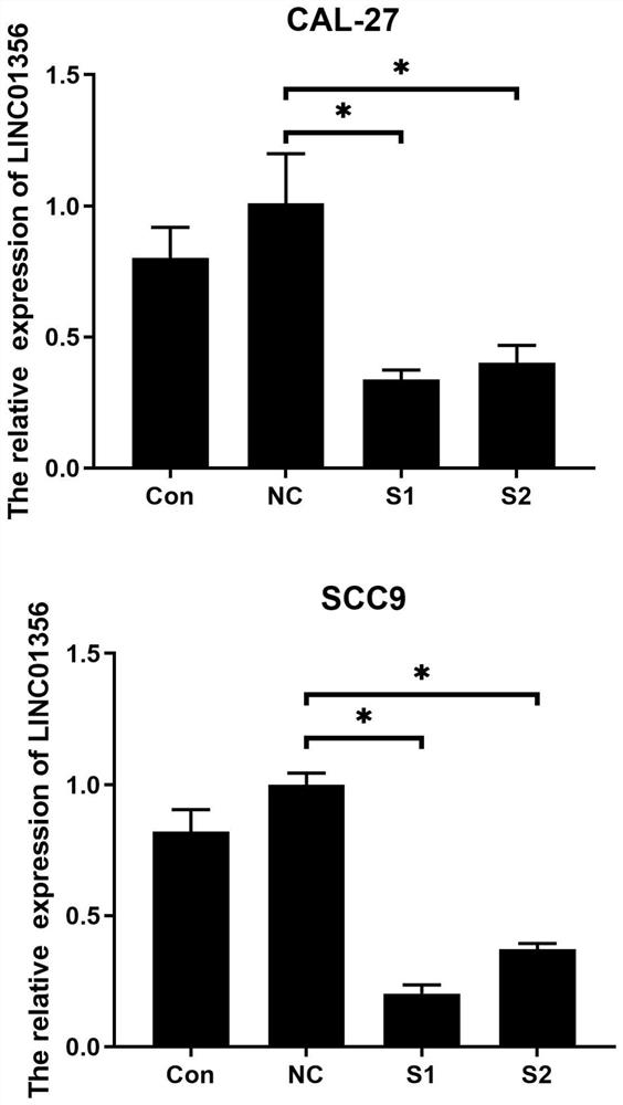 Application of long non-coding RNA in diagnosis and treatment of tongue squamous carcinoma