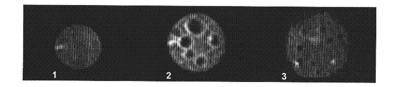 Recombinant lactobacillus rhamnosus engineering strain and preparation method thereof