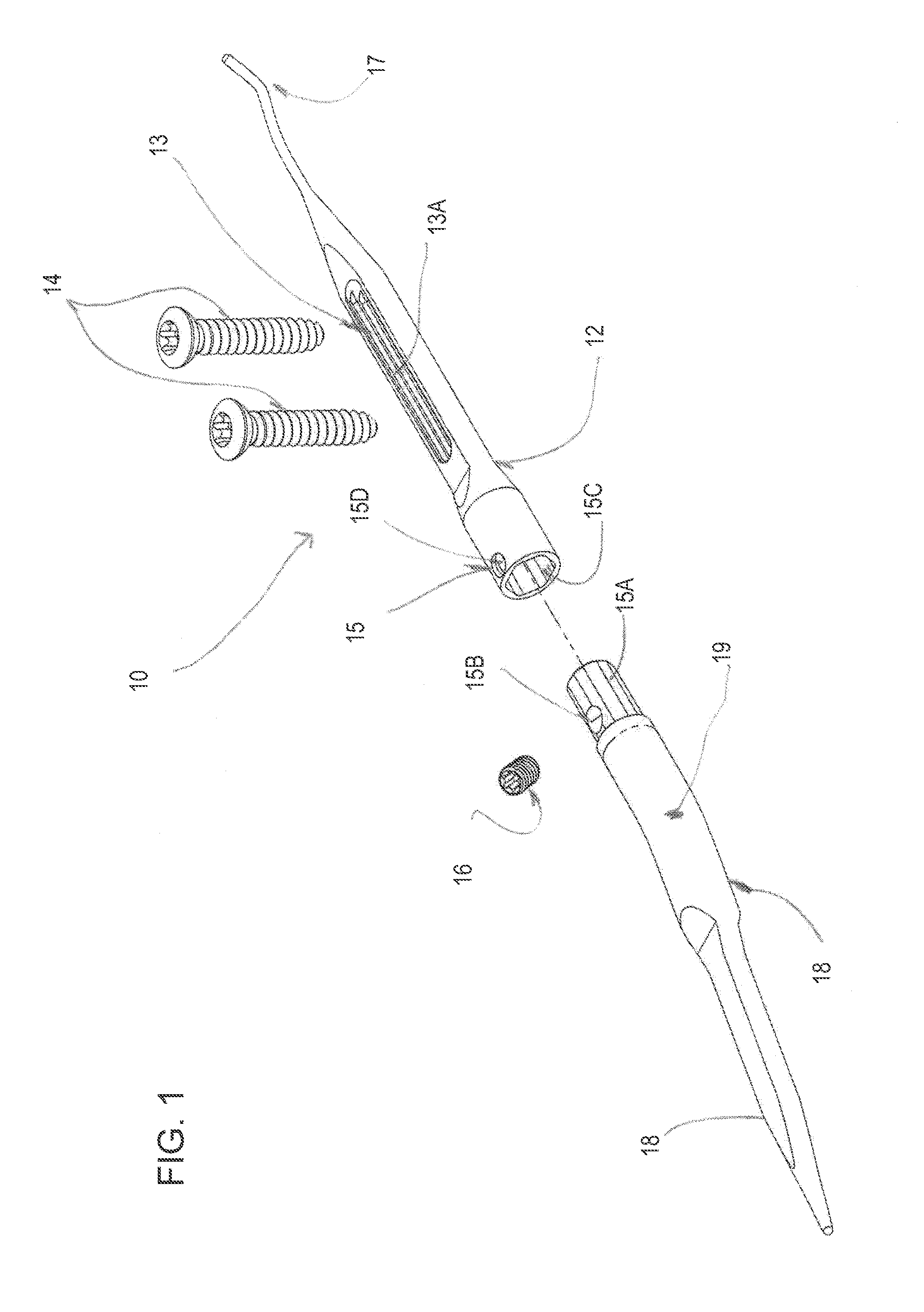 Intramedullary arthrodesis nail and method of use