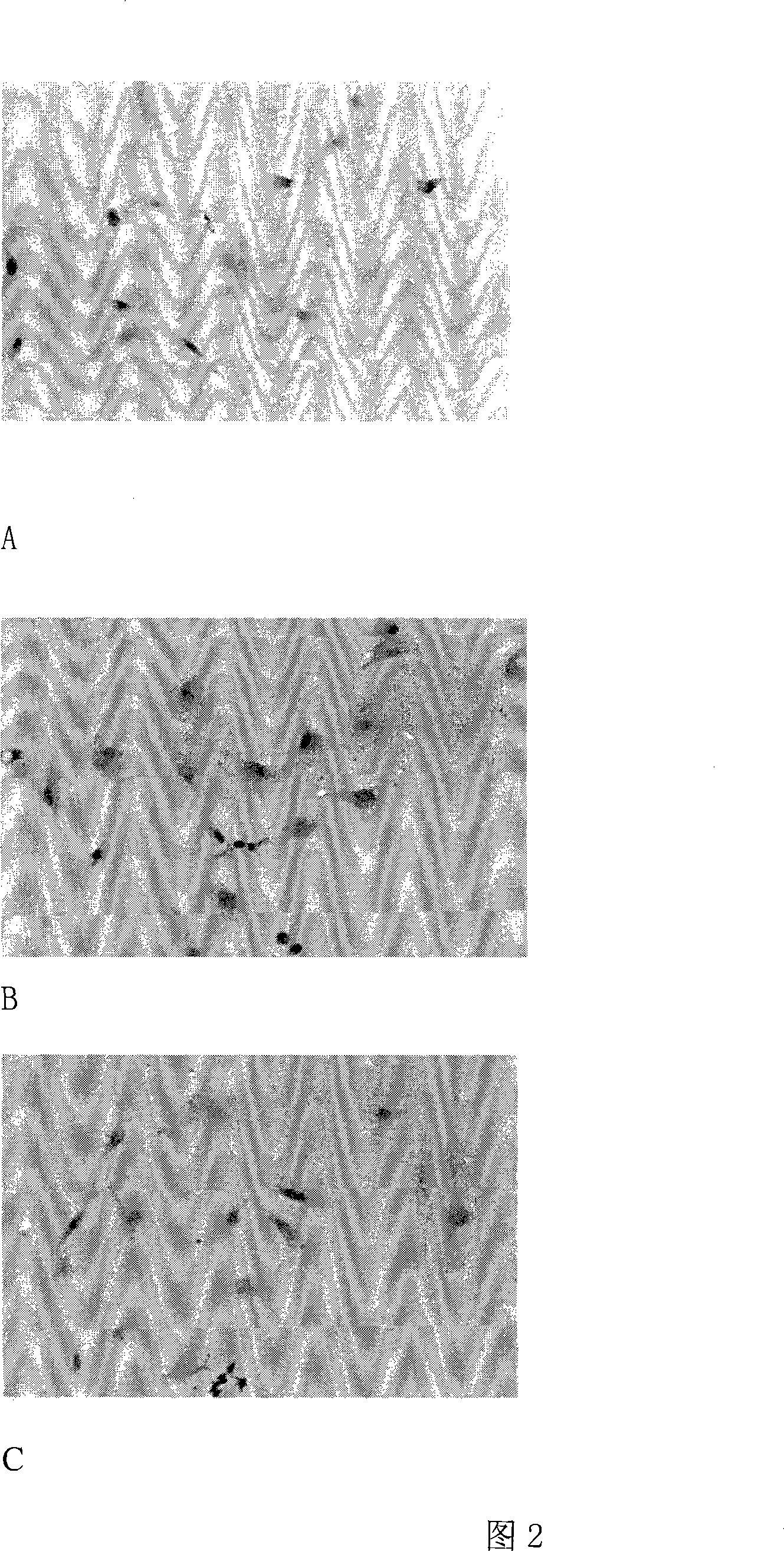 Preparation method of total glycosides of ranunculus and application thereof