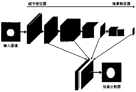 A retinal fundus image segmentation method based on a deep full convolutional neural network