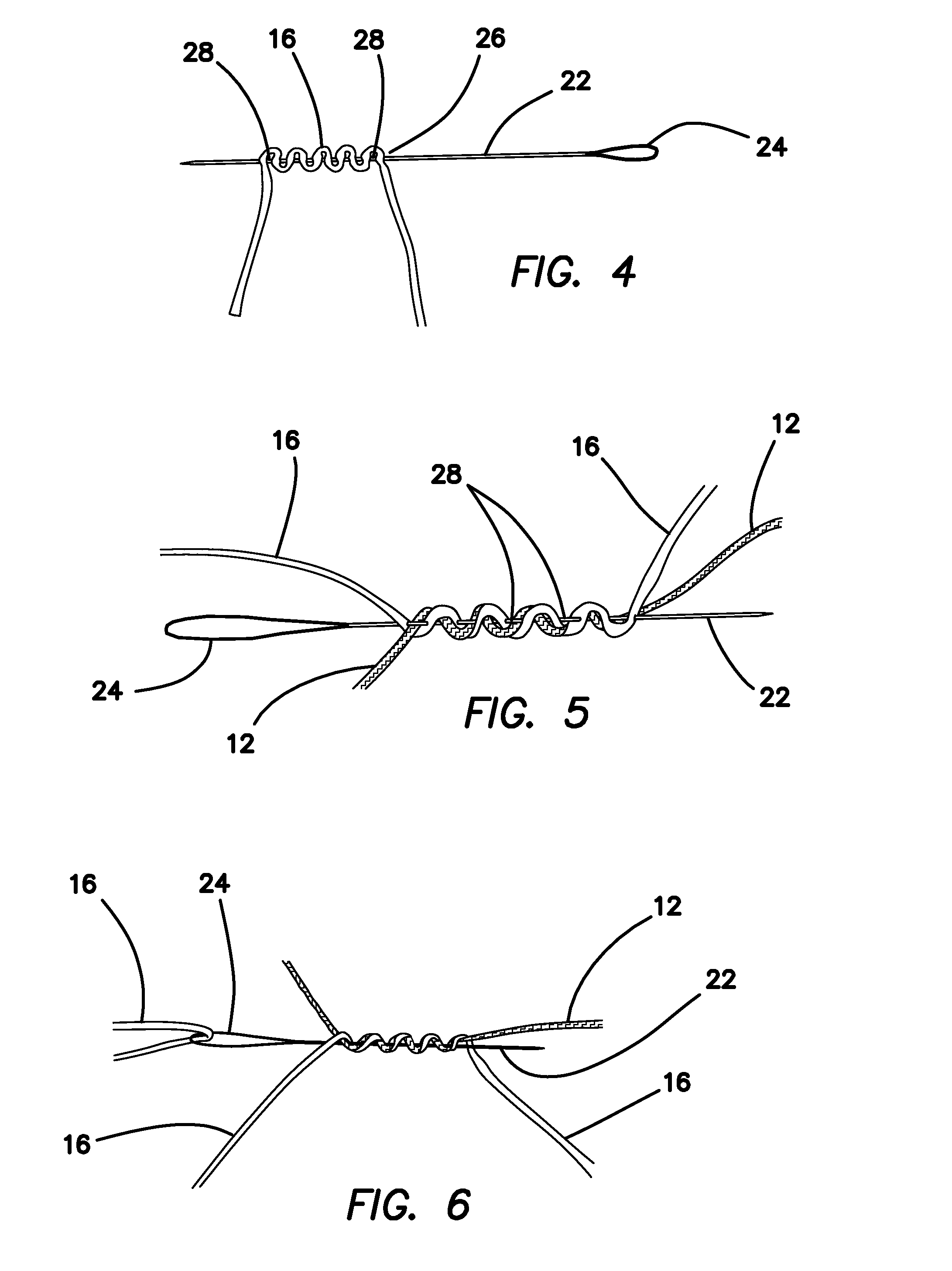 All-suture suture anchor systems and methods