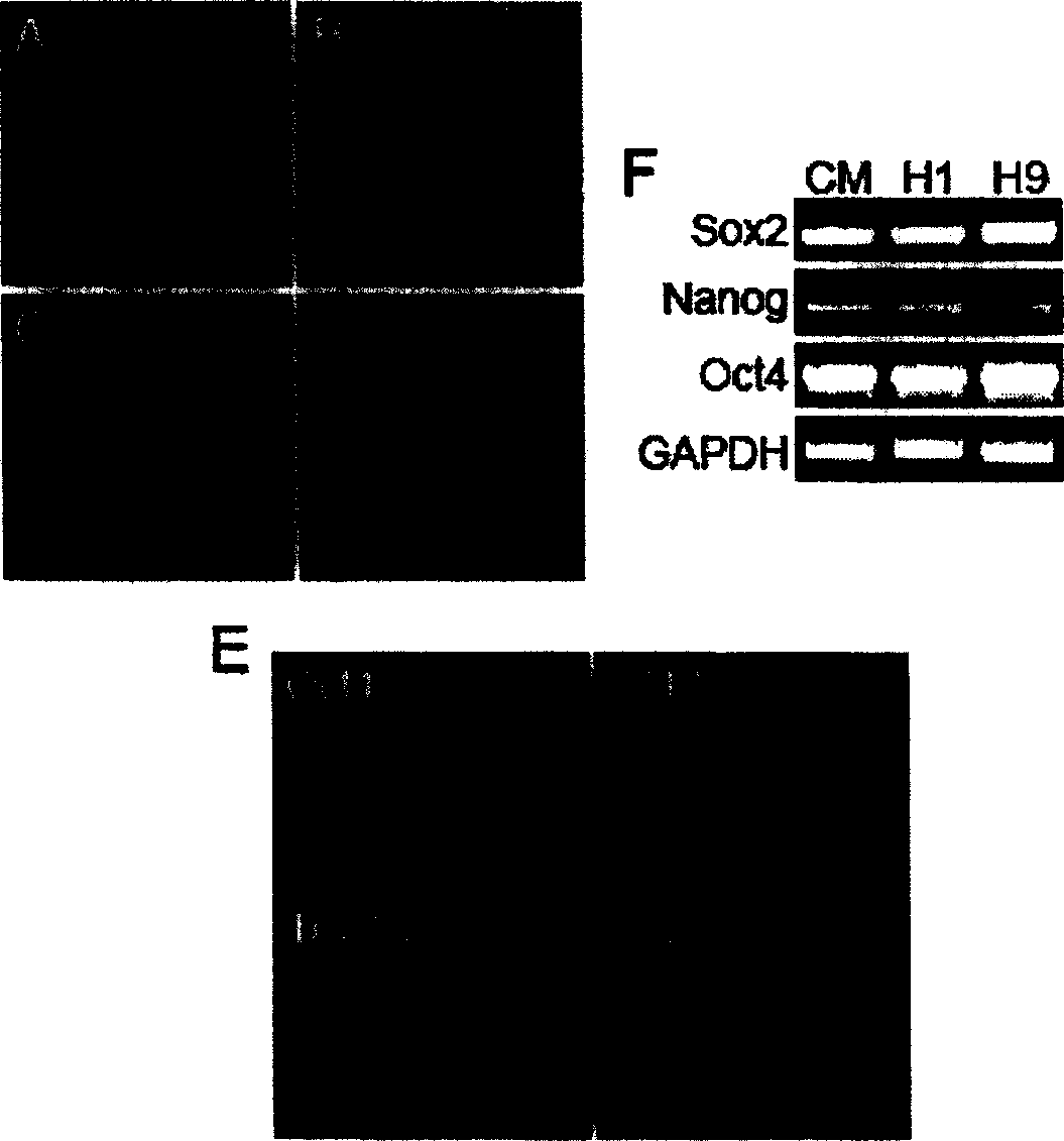 A culturing method of human embryonic stem cells and a special culturing medium thereof