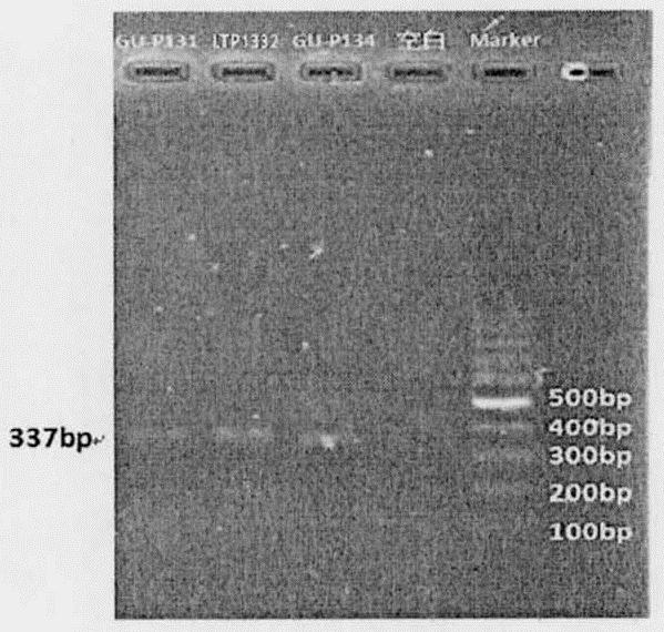 Lactobacillus fermentum strain and its application