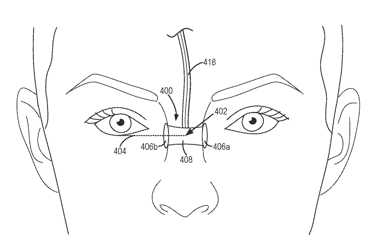 Pulse oximetry sensors and methods