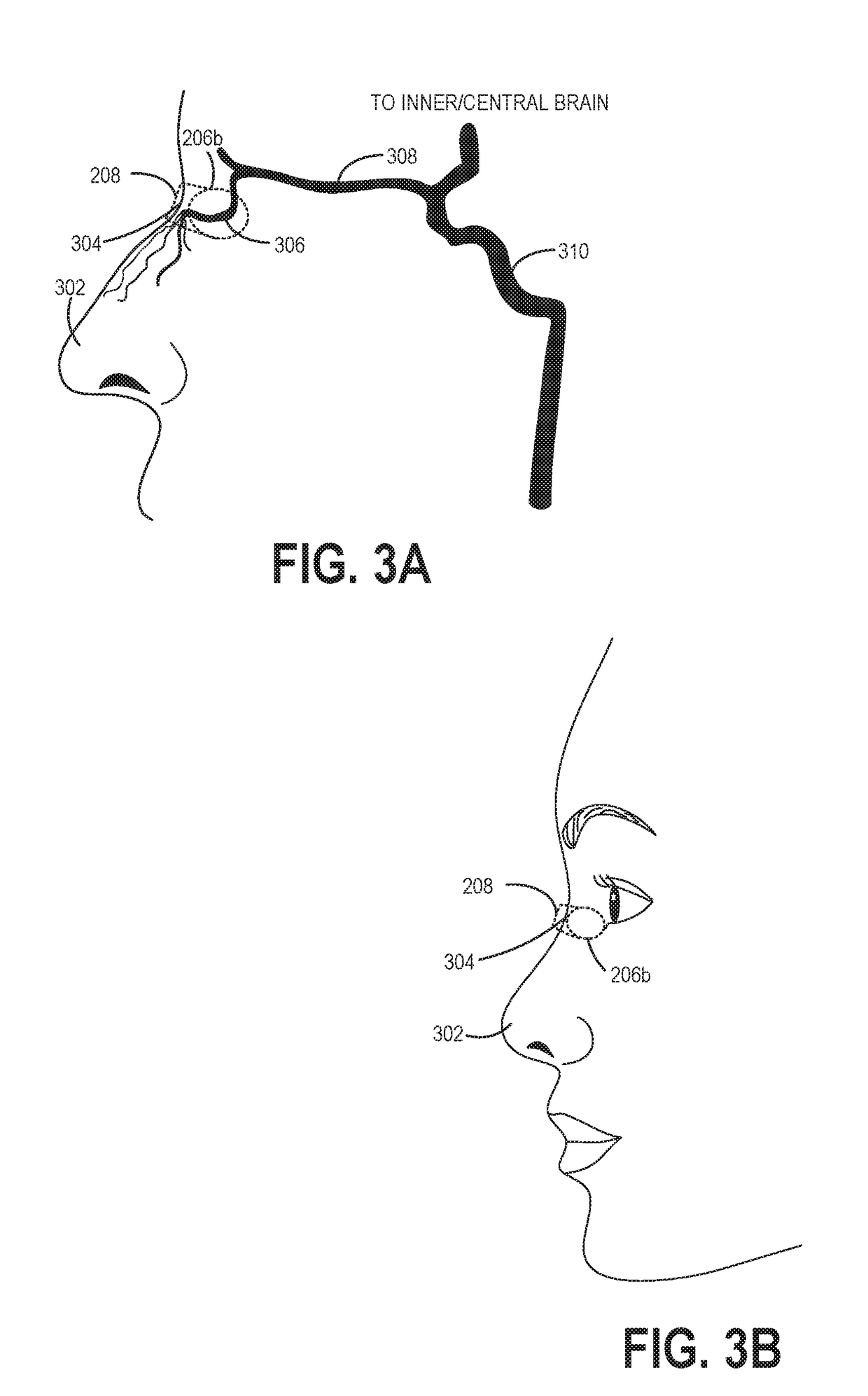 Pulse oximetry sensors and methods