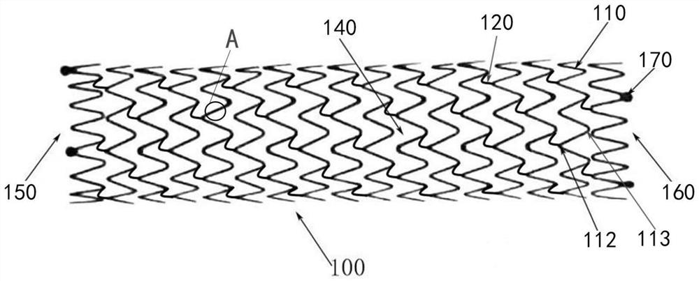 Drug stent