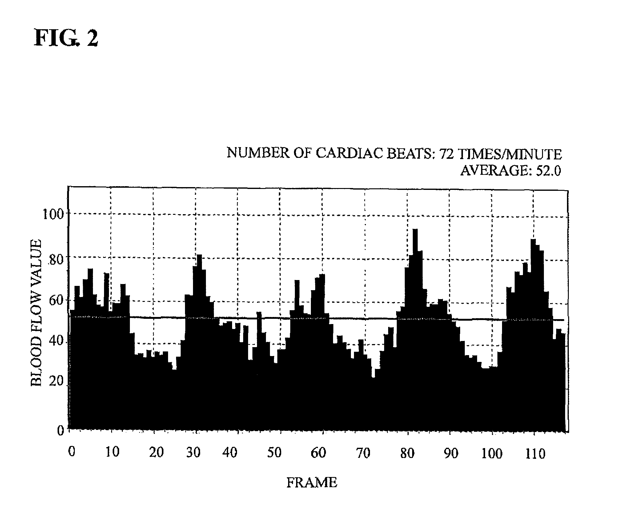 Blood flow rate imaging device