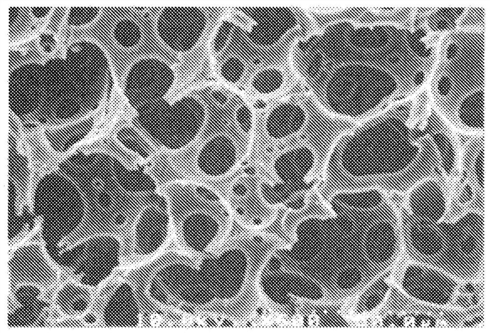 Analysis method of metal impurity content, and analysis kit of metal impurity content