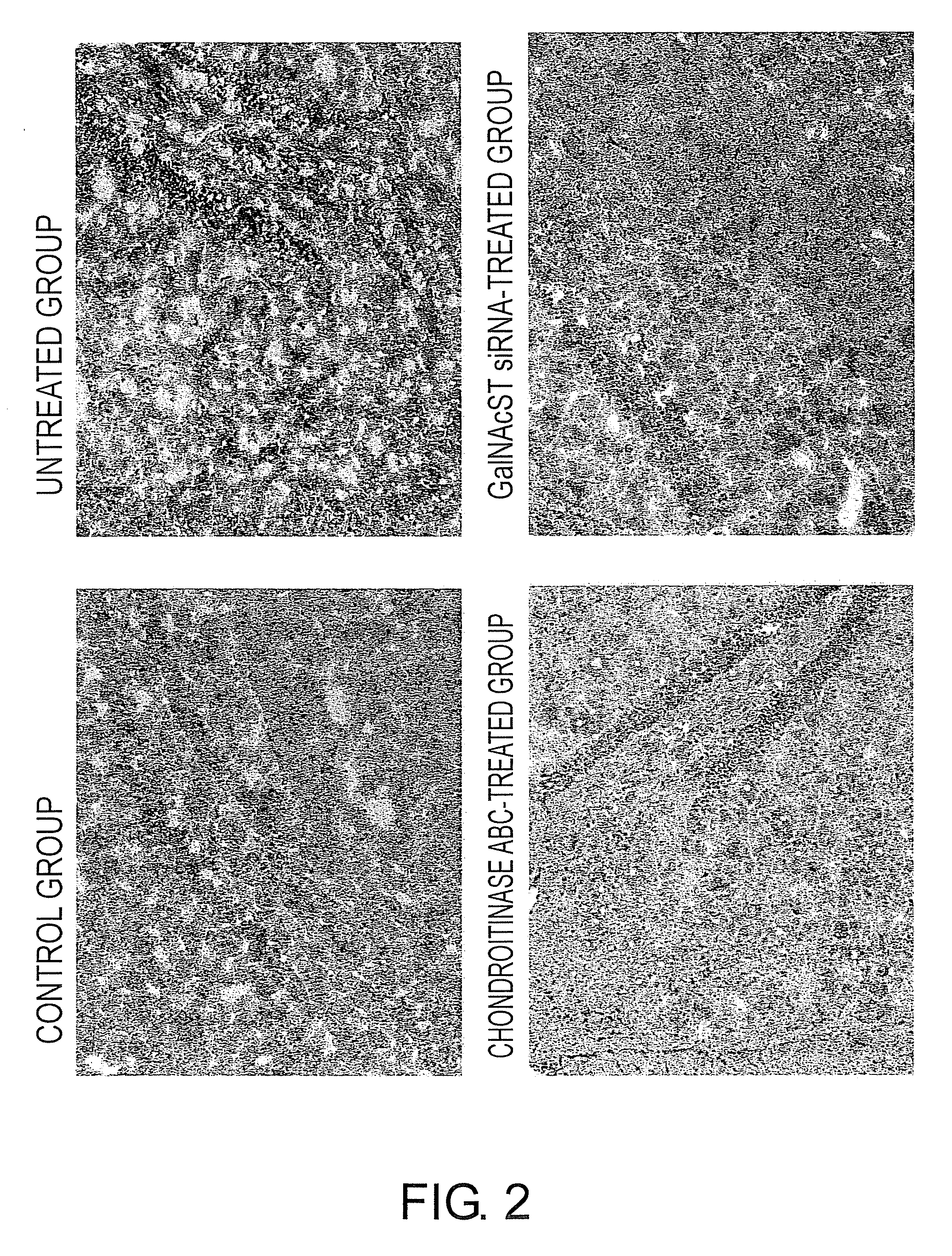 Agents for suppressing neural fibrotic degeneration