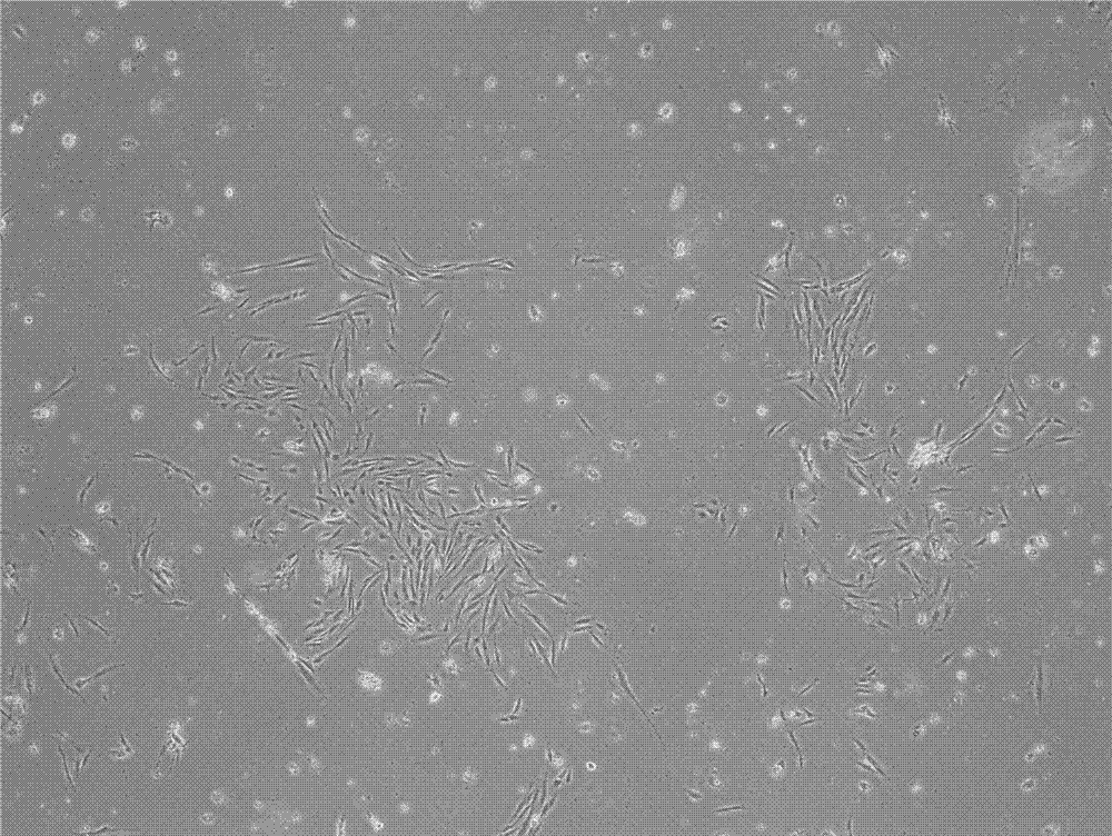 Method for inducing dental pulp mesenchymal stem cells to be differentiated into nerve cells