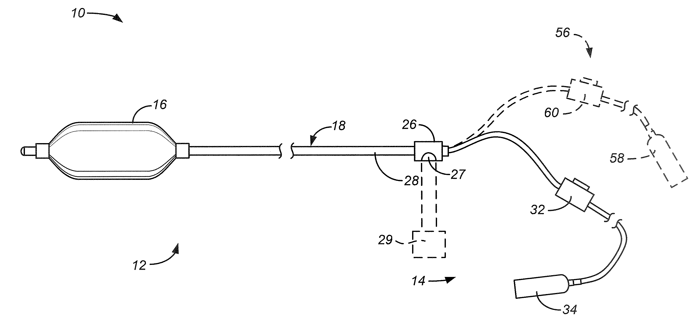 Barrett's Esophagus Cryogenic Ablation System