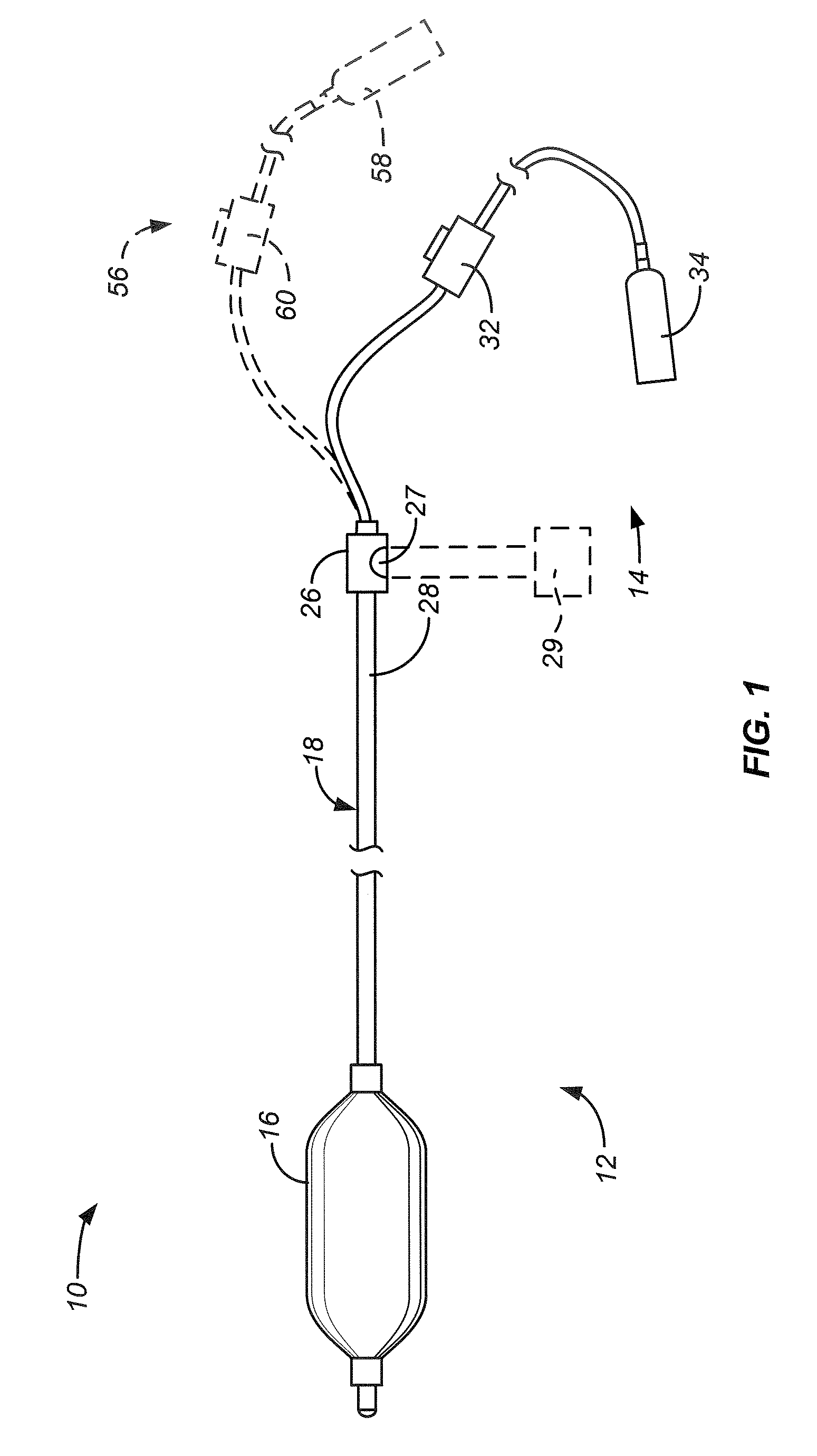 Barrett's Esophagus Cryogenic Ablation System