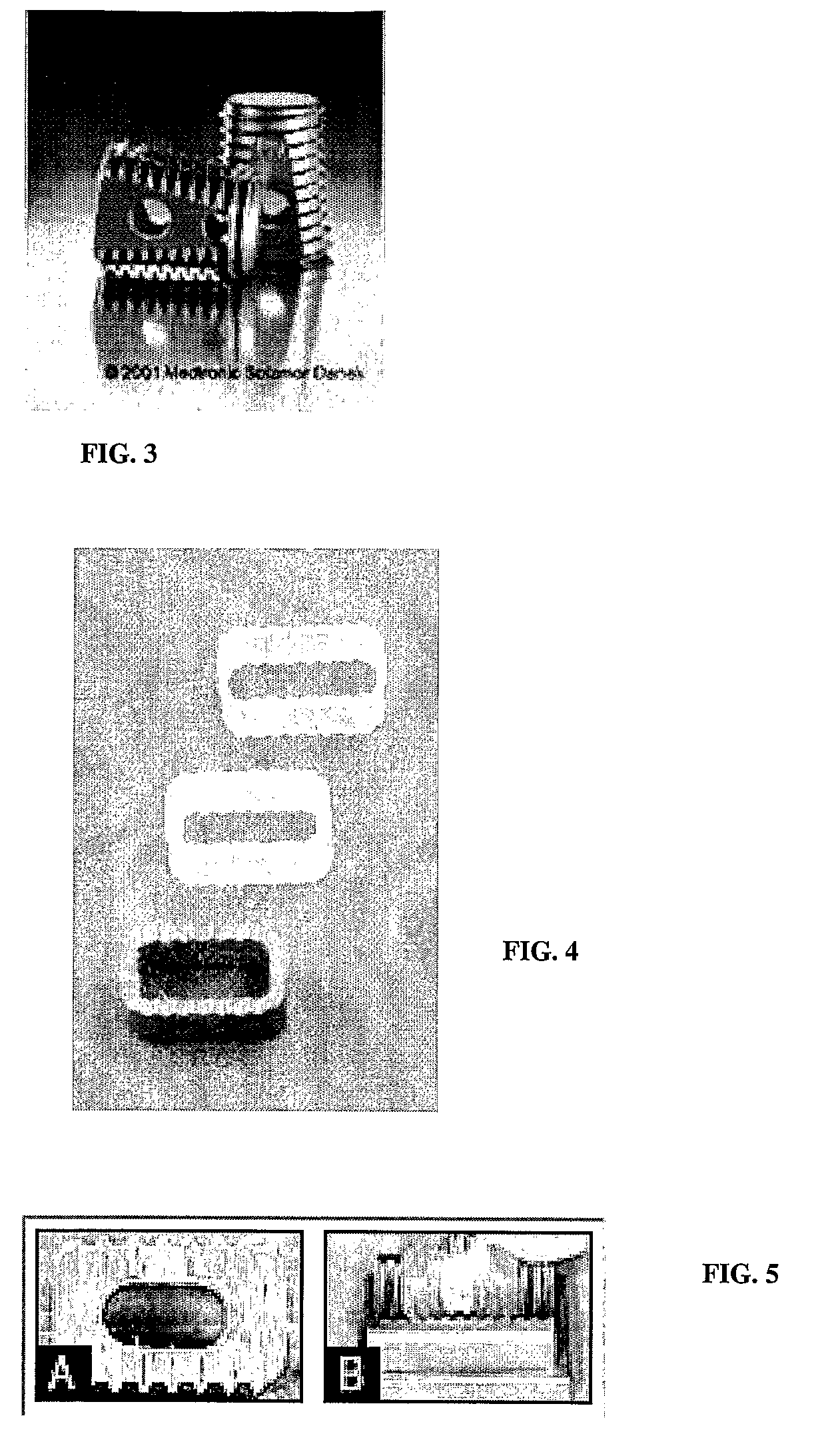 Biodegradable/bioresorbable tissue augmentation/reconstruction device