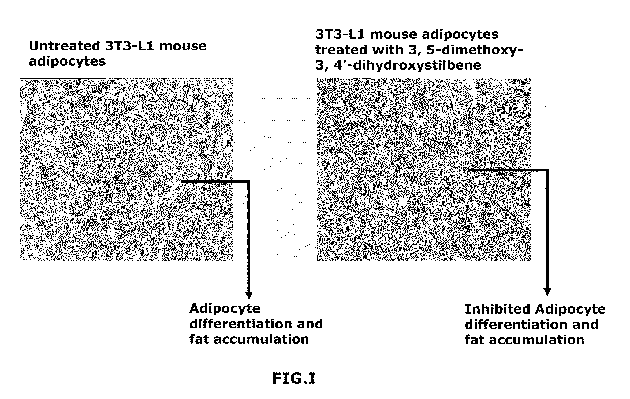 Orally bioavailable stilbenoids- compositions and therapeutic applications thereof