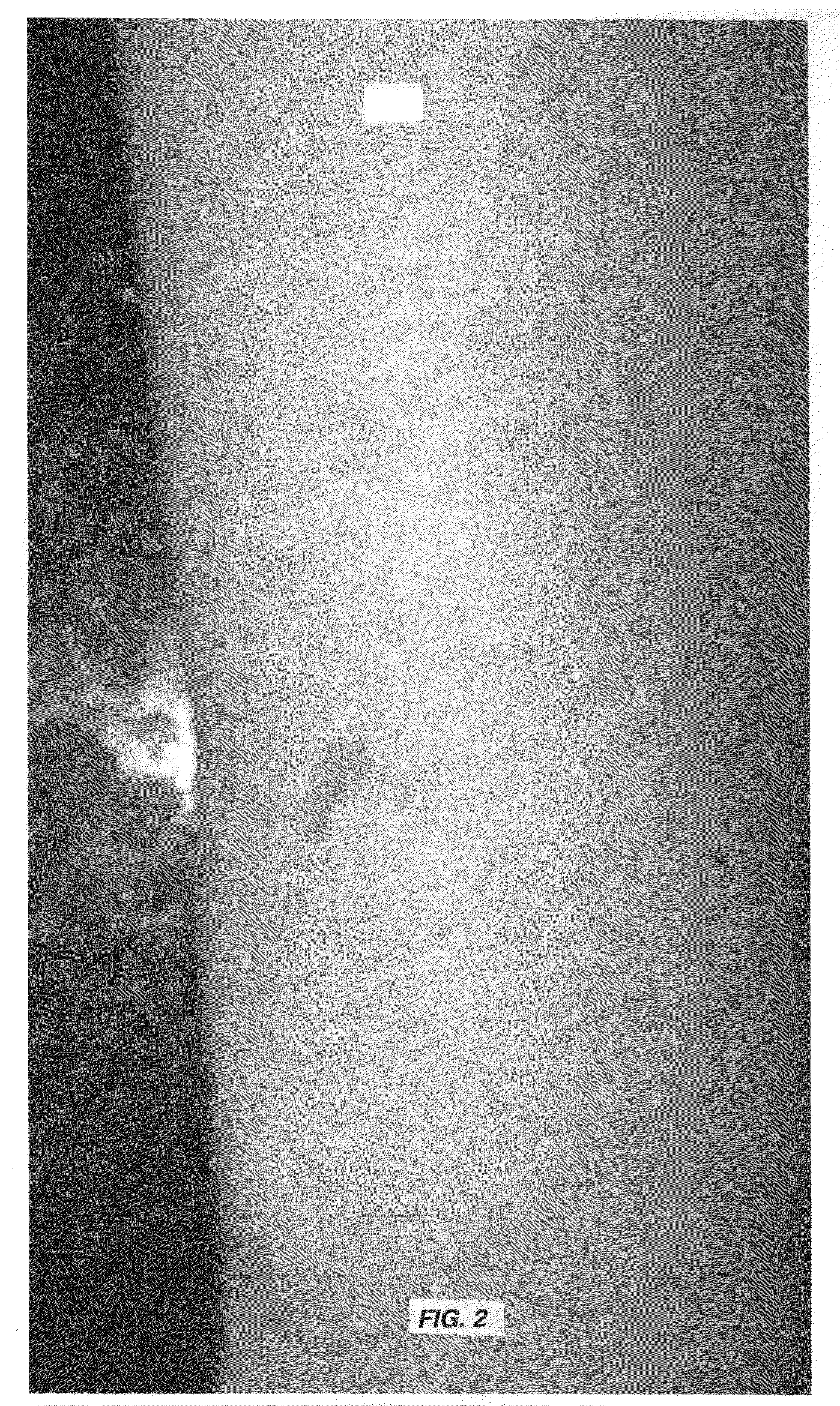 Topical base and active agent-containing compositions, and methods for improving and treating skin