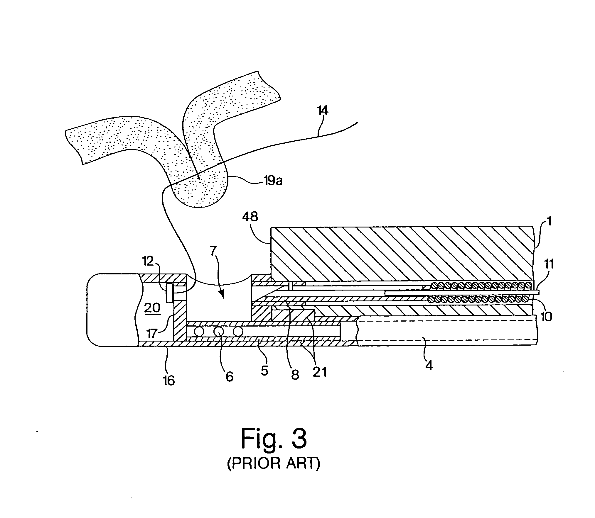 Endoscopic tissue apposition device with multiple suction ports