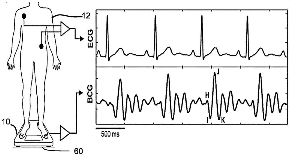 System and method for detecting fluid accumulation