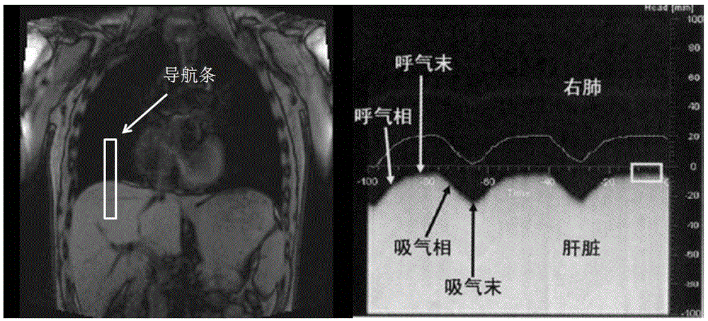 A method and system for cardiac magnetic resonance real-time movie imaging