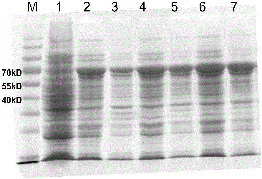 Detection kit for chicken infectious bronchitis indirect ELISA antibody