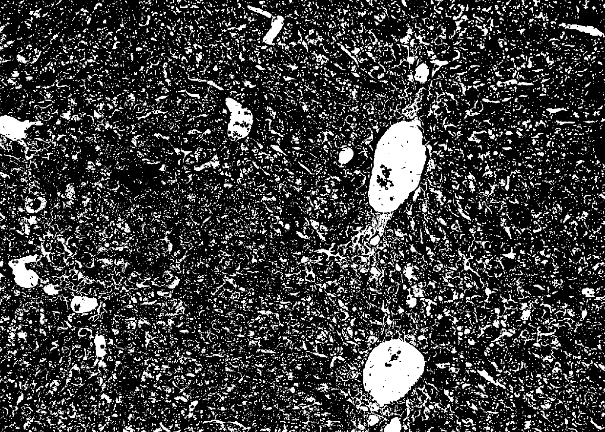 Application of sphingosine kinase inhibitor to preparation of medicine for treating hepatic fibrosis