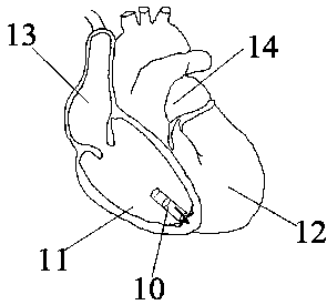 Multi-electrode pace-making modulatable wireless cardiac pacemaker system and manufacturing method