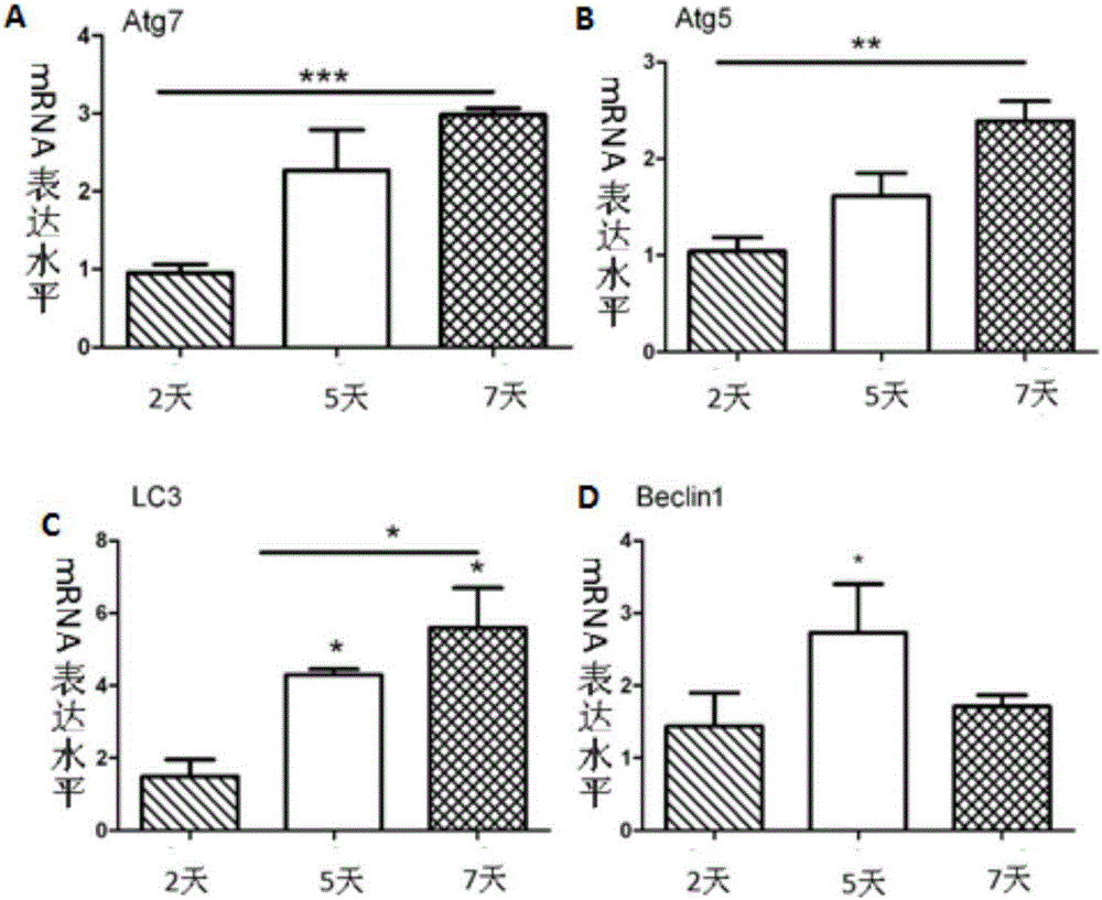 Osteoblast differentiation gene detection kit