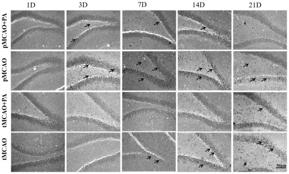 Application of periplaneta americana extract in preparation of cerebral apoplexy recovery product