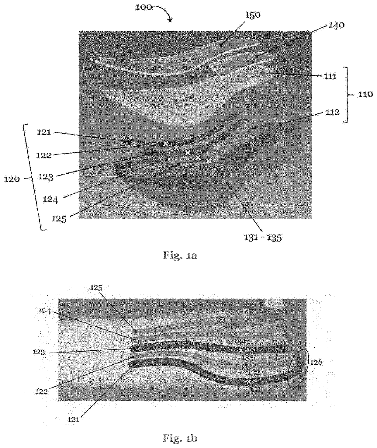 Sole comprising individually deflectable reinforcing members, shoe with such a sole, and method for the manufacture of such items