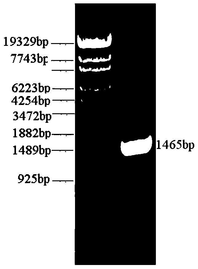 A l-aspartase recombinant Escherichia coli without malic acid by-product and its construction method and application