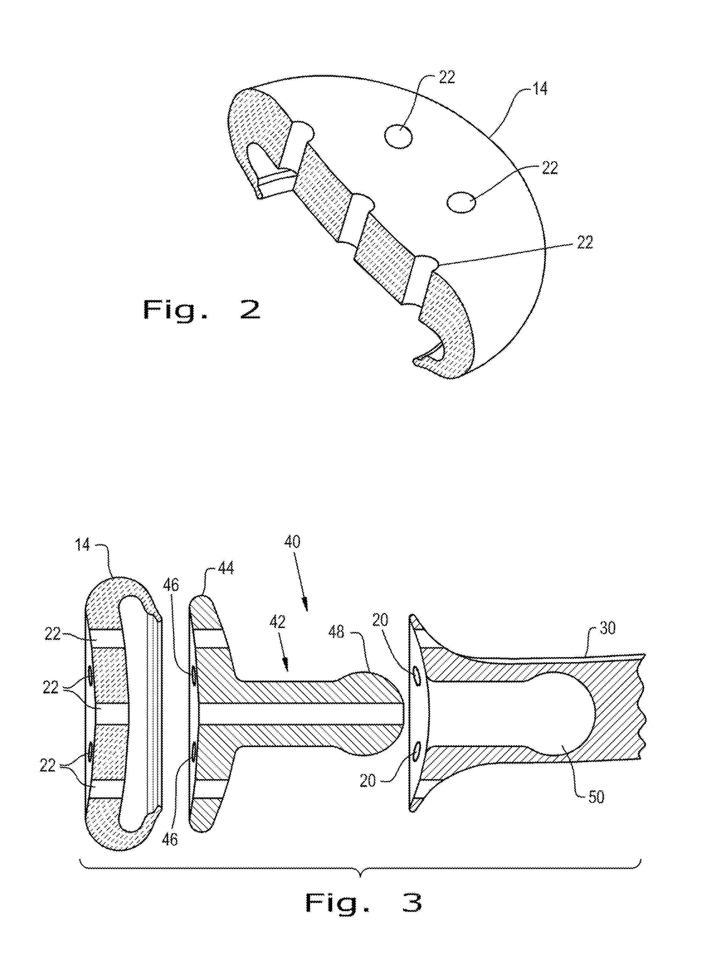 Obstetrical instrument