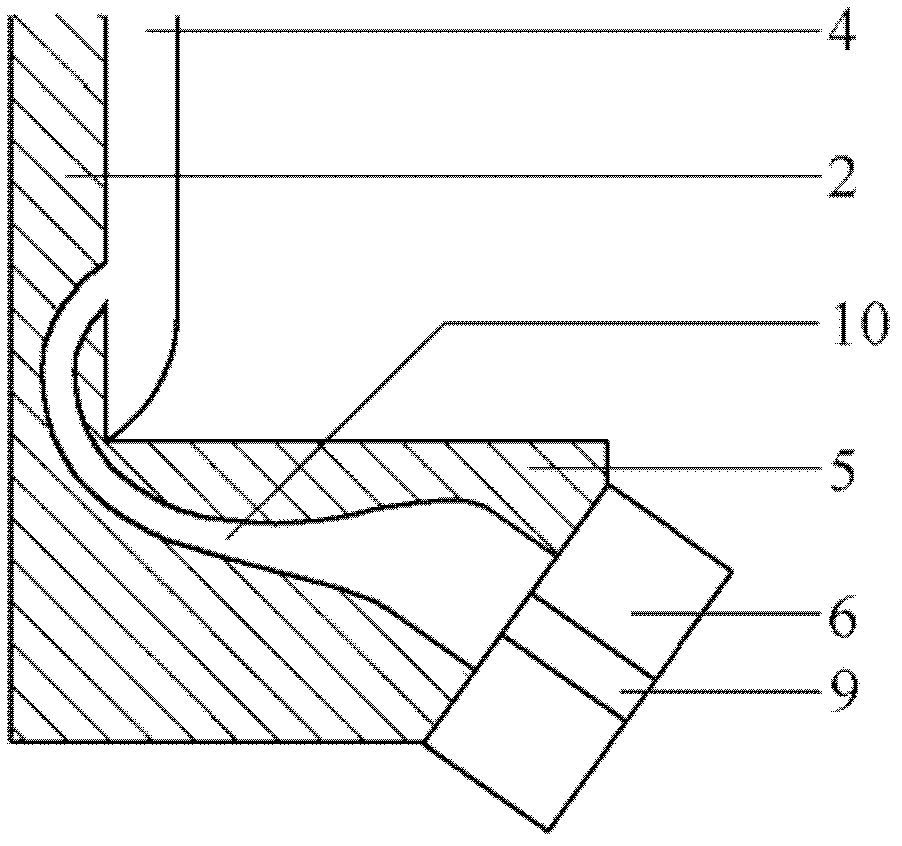 Bladder stoma without urine collecting bag