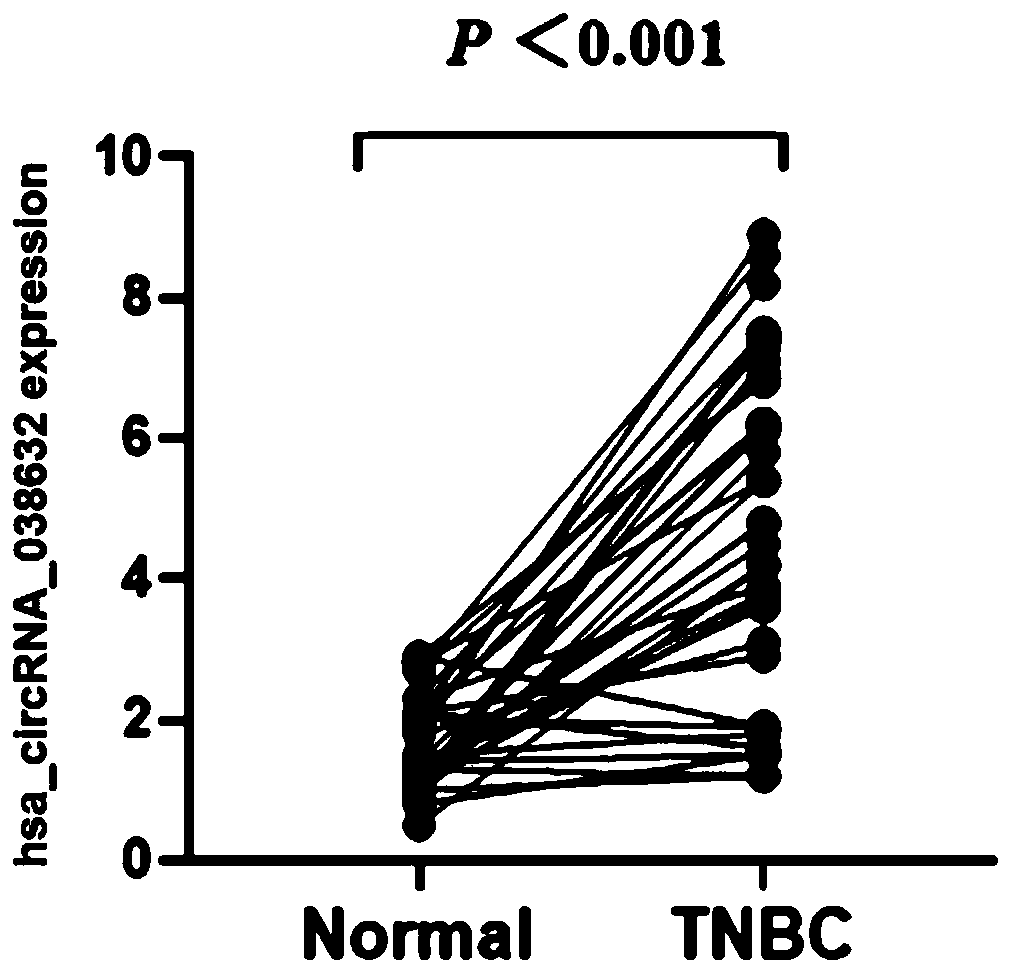 CircRNA detection kit for predicting neoadjuvant chemotherapy reactivity of triple-negative breast cancer (TNBC)