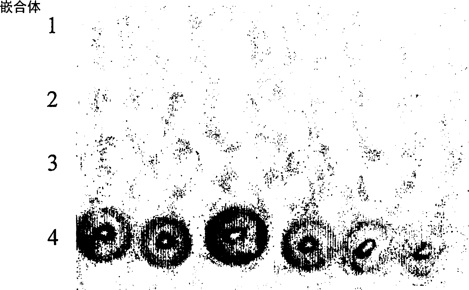 Secreted chlamydia polypeptides, polynucleotides coding therefor, therapeutic and diagnostic uses thereof