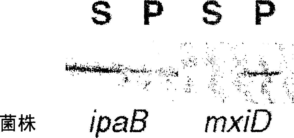 Secreted chlamydia polypeptides, polynucleotides coding therefor, therapeutic and diagnostic uses thereof