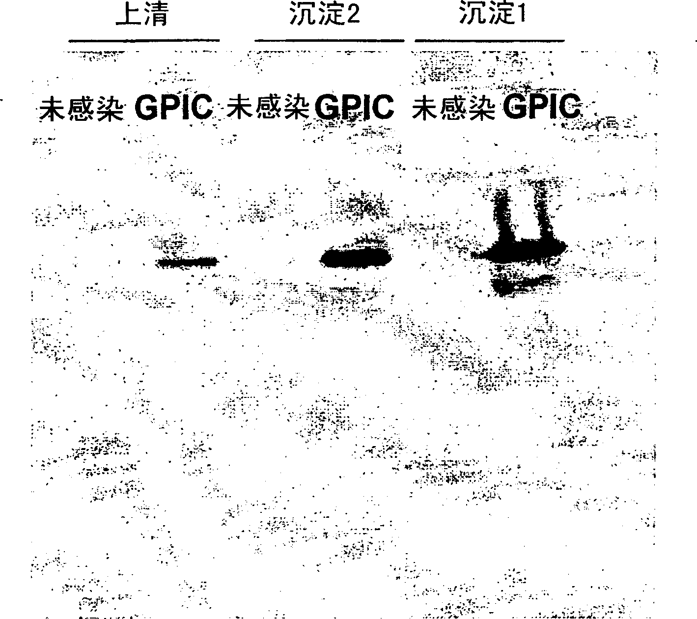 Secreted chlamydia polypeptides, polynucleotides coding therefor, therapeutic and diagnostic uses thereof