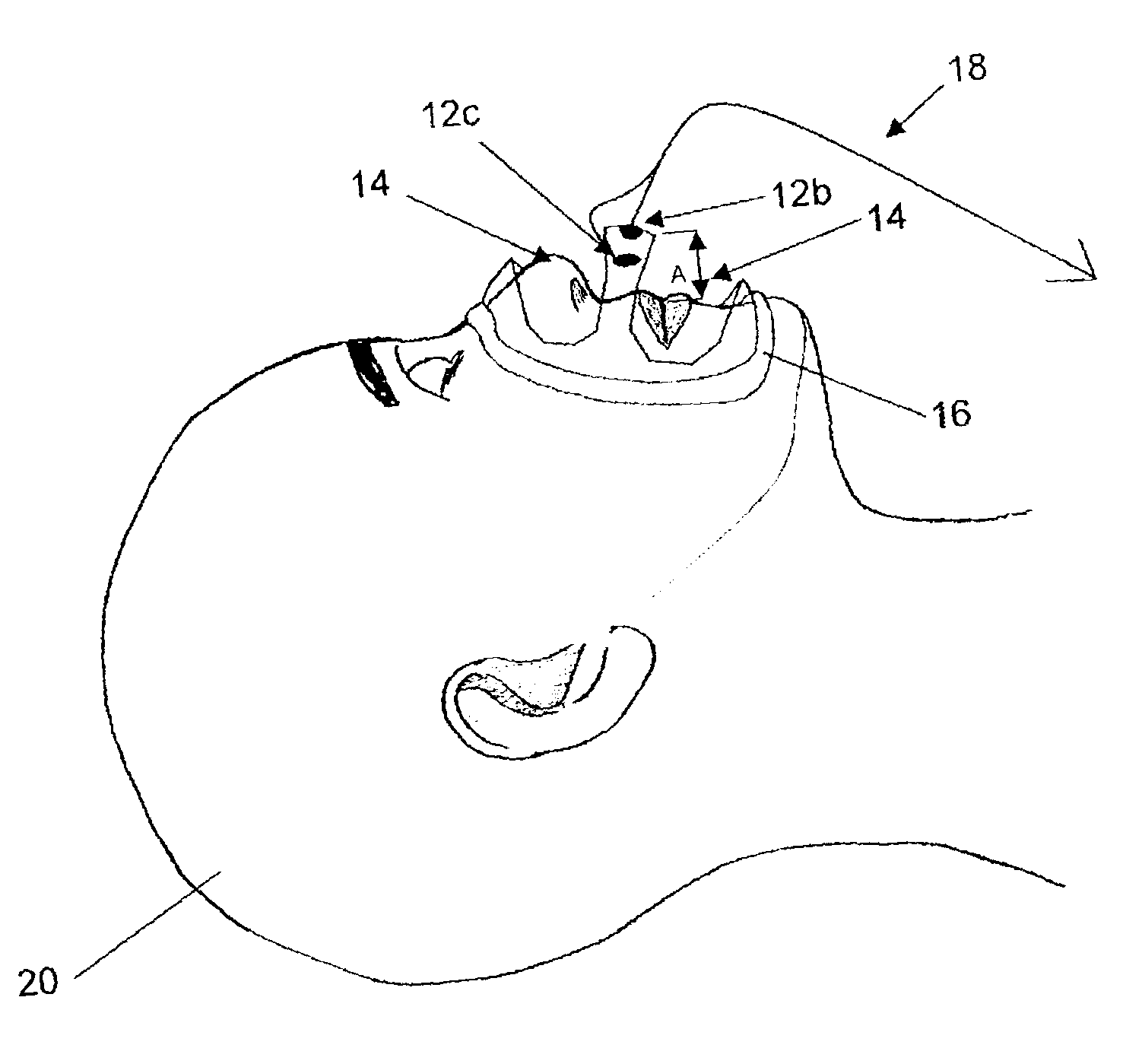 Method and apparatus for monitoring breathing cycle by frequency analysis of an acoustic data stream